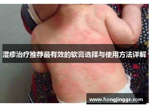 湿疹治疗推荐最有效的软膏选择与使用方法详解